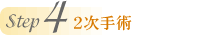 Step4 2次手術